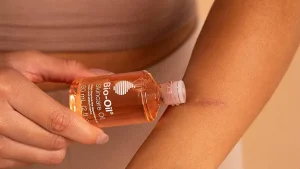 Bio Oil for Stretch Marks